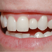 Gum Disease Menu