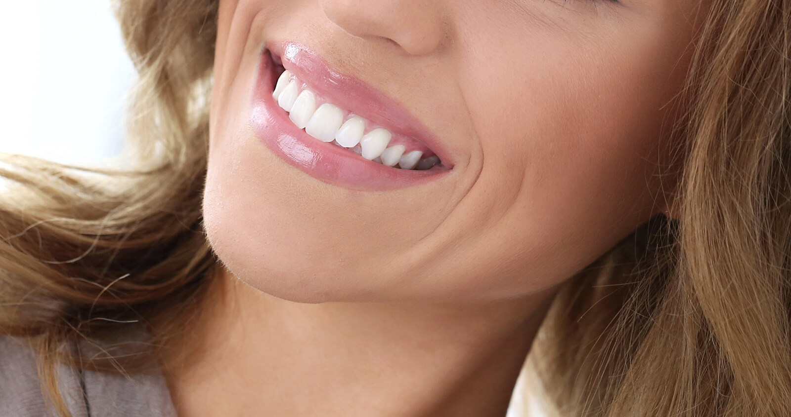 Cosmetic Dental Bonding Treatment at Brampton Dental Arts in Brampton ON Area