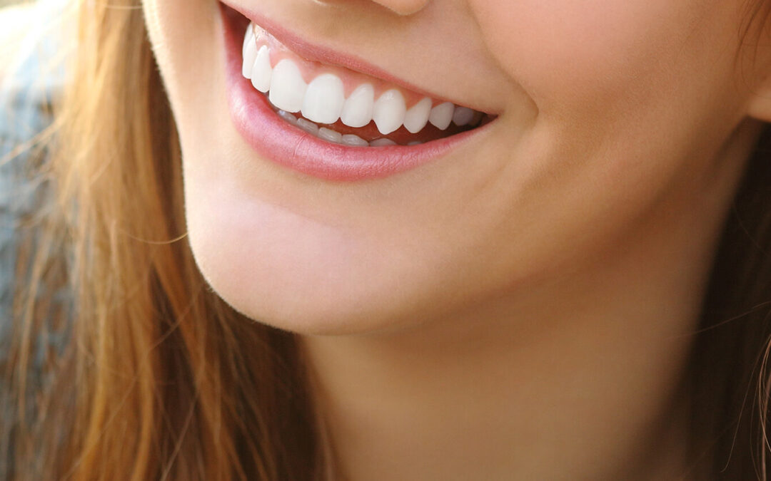 Beautiful Teeth Begin with Diligent Dental Hygiene Care