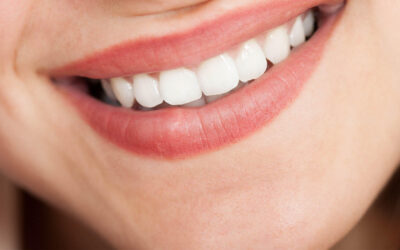 Fix Your Chips and Close Those Gaps With Cosmetic Dental Bonding