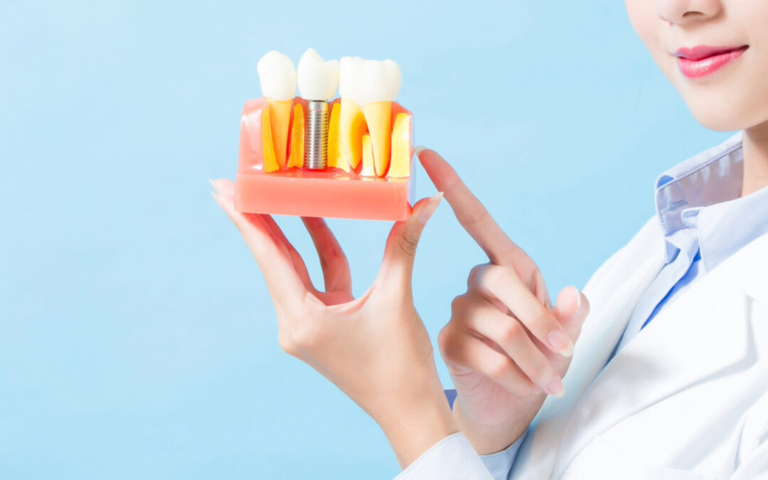 Complete implant care from a leader in this modern form of tooth replacement